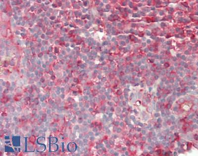 CD86 Antibody - Human Tonsil: Formalin-Fixed, Paraffin-Embedded (FFPE).  This image was taken for the unconjugated form of this product. Other forms have not been tested.