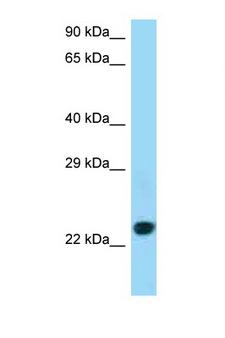 CD86 Antibody - CD86 antibody Western blot of Jurkat Cell lysate. Antibody concentration 1 ug/ml.  This image was taken for the unconjugated form of this product. Other forms have not been tested.