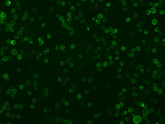 CD86 Antibody - Immunofluorescence staining of B7-2 in Raji cells. Cells were fixed with 4% PFA, blocked with 10% serum, and incubated with rabbit anti-human B7-2 monoclonal antibody (dilution ratio 1:60) at 4°C overnight. Then cells were stained with the Alexa Fluor 488-conjugated Goat Anti-rabbit IgG secondary antibody (green).