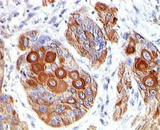 CD86 Antibody - CD86 antibody BU63 immunohistochemistry This image was taken for the unmodified form of this product. Other forms have not been tested.