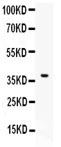 CD86 Antibody - Western blot testing of CD86 antibody and recombinant human protein (0.5ng)
