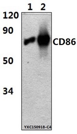CD86 Antibody - Western blot of CD86(7H3) mAb at 1:2000 dilution. Lane 1: The Spleen tissue lysate of Rat(15ug). Lane 2: The Spleen tissue lysate of Mouse(15ug).