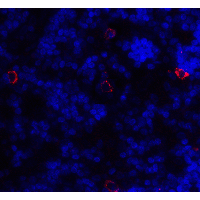 CD86 Antibody - Immunofluorescence of CD86 in human lymph node tissue with CD86 antibody at 20 µg/ml.