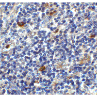 CD86 Antibody - Immunohistochemistry of CD86 in human lymph node tissue with CD86 antibody at 2 µg/ml.