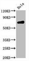 CD86 Antibody - Western Blot Positive WB detected in:Hela whole cell lysate All Lanes:CD86 antibody at 0.55µg/ml Secondary Goat polyclonal to rabbit IgG at 1/50000 dilution Predicted band size: 70 KDa Observed band size: 70 KDa
