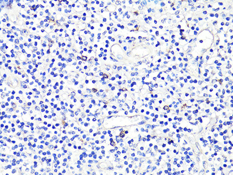 CD86 Antibody - Immunohistochemistry of paraffin-embedded human tonsil using CD86 antibody at dilution of 1:100 (40x lens).