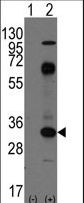CD8A / CD8 Alpha Antibody - Western blot of CD8A(arrow) using rabbit polyclonal CD8A Antibody. 293 cell lysates (2 ug/lane) either nontransfected (Lane 1) or transiently transfected with the CD8A gene (Lane 2) (Origene Technologies).