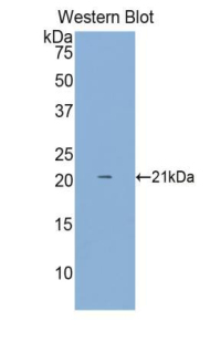 CD8A / CD8 Alpha Antibody - Western blot of recombinant CD8A / CD8 Alpha.  This image was taken for the unconjugated form of this product. Other forms have not been tested.