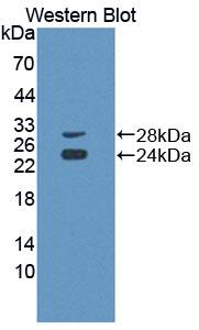 CD8A / CD8 Alpha Antibody - Western Blot; Sample: Recombinant protein.