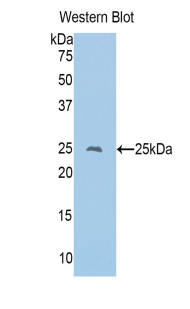 CD8A / CD8 Alpha Antibody - Western blot of recombinant CD8A / CD8 Alpha.  This image was taken for the unconjugated form of this product. Other forms have not been tested.