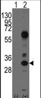 CD8A / CD8 Alpha Antibody - Western blot of CD8A(arrow) using rabbit polyclonal CD8A Antibody. 293 cell lysates (2 ug/lane) either nontransfected (Lane 1) or transiently transfected with the CD8A gene (Lane 2) (Origene Technologies).