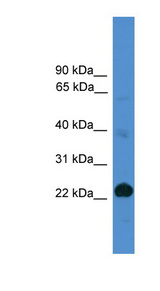 CD8A / CD8 Alpha Antibody - CD8A antibody Western blot of 721_B cell lysate. This image was taken for the unconjugated form of this product. Other forms have not been tested.