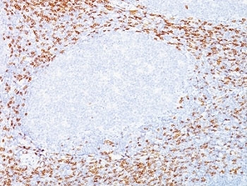 CD8A / CD8 Alpha Antibody - Formalin-fixed, paraffin-embedded human tonsil stained with CD8a antibody (C8/468 + C8/144B).  This image was taken for the unmodified form of this product. Other forms have not been tested.
