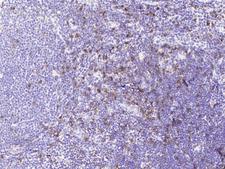 CD8A / CD8 Alpha Antibody - Immunochemical staining CD8A in human lymph node with mouse monoclonal antibody at 1:200 dilution, formalin-fixed paraffin embedded sections.