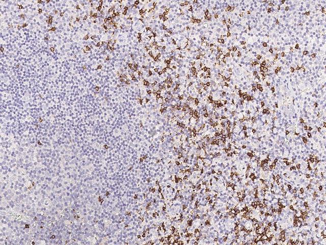 CD8A / CD8 Alpha Antibody - Immunochemical staining CD8A in human tonsil with mouse monoclonal antibody at 1:200 dilution, formalin-fixed paraffin embedded sections.