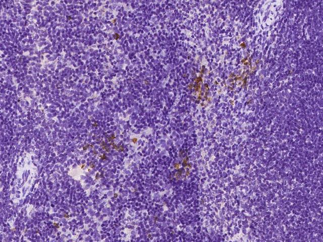 CD8A / CD8 Alpha Antibody - Immunochemical staining CD8A in mouse spleen with mouse monoclonal antibody at 1:200 dilution, formalin-fixed paraffin embedded sections.