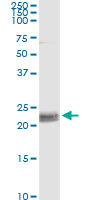 CD8A / CD8 Alpha Antibody - Immunoprecipitation of CD8A transfected lysate using anti-CD8A monoclonal antibody and Protein A Magnetic Bead, and immunoblotted with CD8A rabbit polyclonal antibody.