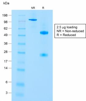 CD8A / CD8 Alpha Antibody - SDS-PAGE Analysis of Purified CD8a Rabbit Recombinant Monoclonal Antibody (C8/1779R). Confirmation of Purity and Integrity of Antibody.
