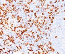 CD8A / CD8 Alpha Antibody - CD8a antibody immunohistochemistry.  This image was taken for the unmodified form of this product. Other forms have not been tested.