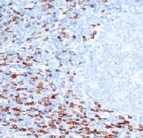CD8A / CD8 Alpha Antibody - IHC analysis of human tonsil and CD8a antibody (CLDA8a-1).  This image was taken for the unmodified form of this product. Other forms have not been tested.