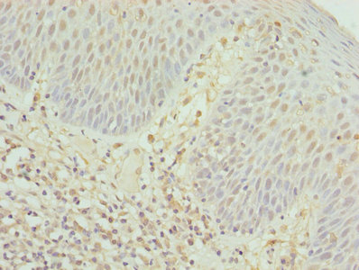 CD8A / CD8 Alpha Antibody - Immunohistochemistry of paraffin-embedded human tonsil tissue using CD8A Antibody at dilution of 1:100