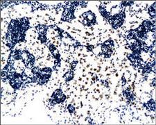 CD8A / CD8 Alpha Antibody - Paraffin-embedded rat pancreas is stained with CD8 Antibody used at a 1:30 dilution.