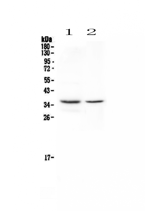 CD8A / CD8 Alpha Antibody - Western blot - Anti-CD8 alpha Picoband antibody