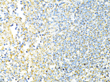 CD8A / CD8 Alpha Antibody - Immunohistochemistry of paraffin-embedded human tonsil using CD8A antibody at dilution of 1:100 (40x lens).