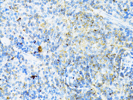 CD8A / CD8 Alpha Antibody - Immunohistochemistry of paraffin-embedded mouse spleen using CD8A antibody at dilution of 1:100 (40x lens).
