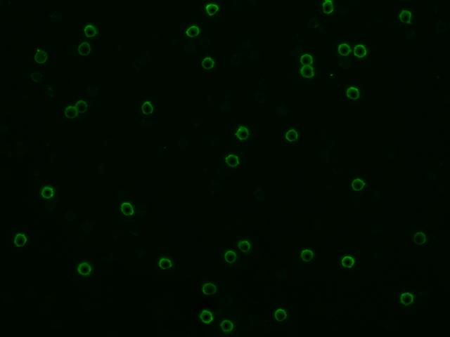 CD8A / CD8 Alpha Antibody - Immunofluorescence staining of mCD8A-His in Mouse Spleen cells. Cells were fixed with 4% PFA, permeabilzed with 0.3% Triton X-100 in PBS, blocked with 10% serum, and incubated with rabbit anti-MOUSE mCD8A-His polyclonal antibody (dilution ratio 1:1000) at 4°C overnight. Then cells were stained with the Alexa Fluor 488-conjugated Goat Anti-rabbit IgG secondary antibody (green). Positive staining was localized to cell membrane.
