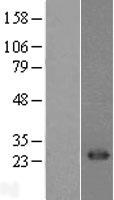 CD8A / CD8 Alpha Protein - Western validation with an anti-DDK antibody * L: Control HEK293 lysate R: Over-expression lysate