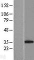 CD8A / CD8 Alpha Protein - Western validation with an anti-DDK antibody * L: Control HEK293 lysate R: Over-expression lysate