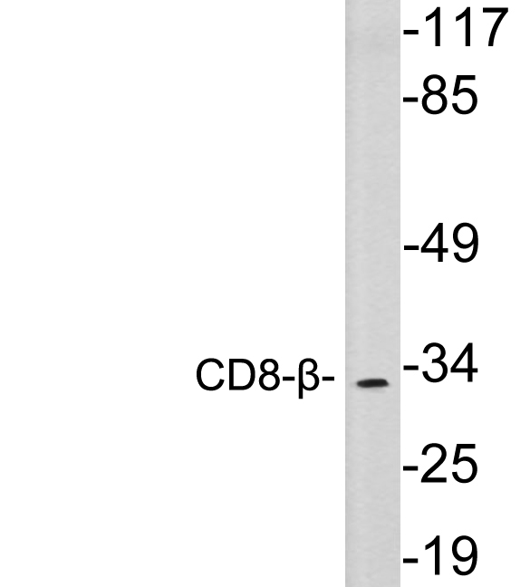 CD8B / CD8 Beta Antibody - Western blot analysis of lysates from Jurkat cells, using CD8-Î² antibody.
