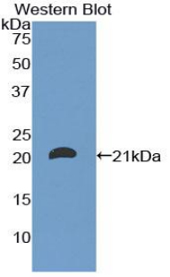 CD8B / CD8 Beta Antibody - Western blot of recombinant CD8B / CD8 Beta.  This image was taken for the unconjugated form of this product. Other forms have not been tested.