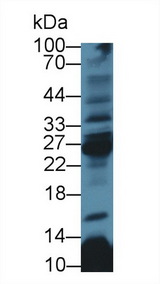 CD8B / CD8 Beta Antibody - Western Blot; Sample: Rat Thymus lysate; Primary Ab: 3µg/ml Rabbit Anti-Human CD8b Antibody Second Ab: 0.2µg/mL HRP-Linked Caprine Anti-Rabbit IgG Polyclonal Antibody