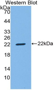 CD8B / CD8 Beta Antibody - Western Blot; Sample: Recombinant protein.
