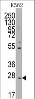CD8B / CD8 Beta Antibody - Western blot of anti-CD8B1 antibody in K562 cell line lysates (35 ug/lane). CD8B1(arrow) was detected using the purified antibody.