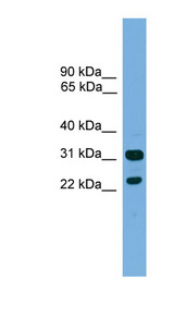 CD8B / CD8 Beta Antibody - CD8B antibody Western blot of ACHN lysate. This image was taken for the unconjugated form of this product. Other forms have not been tested.
