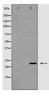 CD8B / CD8 Beta Antibody - Western blot of CD8B expression in Jurkat cells