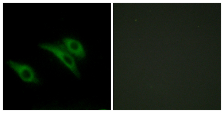 CD9 Antibody - Immunofluorescence analysis of HeLa cells, using CD9 Antibody. The picture on the right is blocked with the synthesized peptide.
