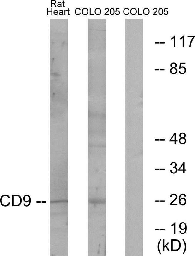 CD9 Antibody - Western blot analysis of lysates from rat heart and COLO cells, using CD9 Antibody. The lane on the right is blocked with the synthesized peptide.