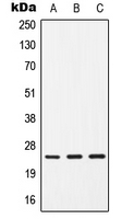 CD9 Antibody - Western blot analysis of CD9 expression in HepG2 (A); SP2/0 (B); H9C2 (C) whole cell lysates.