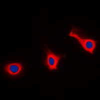 CD9 Antibody - Immunofluorescent analysis of CD9 staining in HEK293T cells. Formalin-fixed cells were permeabilized with 0.1% Triton X-100 in TBS for 5-10 minutes and blocked with 3% BSA-PBS for 30 minutes at room temperature. Cells were probed with the primary antibody in 3% BSA-PBS and incubated overnight at 4 C in a humidified chamber. Cells were washed with PBST and incubated with a DyLight 594-conjugated secondary antibody (red) in PBS at room temperature in the dark. DAPI was used to stain the cell nuclei (blue).