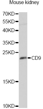 CD9 Antibody - Western blot analysis of extracts of mouse kidney, using CD9 antibody at 1:1000 dilution. The secondary antibody used was an HRP Goat Anti-Rabbit IgG (H+L) at 1:10000 dilution. Lysates were loaded 25ug per lane and 3% nonfat dry milk in TBST was used for blocking. An ECL Kit was used for detection.
