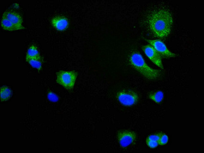 CD9 Antibody - Immunofluorescence staining of MCF-7 cells diluted at 1:34,counter-stained with DAPI. The cells were fixed in 4% formaldehyde, permeabilized using 0.2% Triton X-100 and blocked in 10% normal Goat Serum. The cells were then incubated with the antibody overnight at 4°C.The Secondary antibody was Alexa Fluor 488-congugated AffiniPure Goat Anti-Rabbit IgG (H+L).
