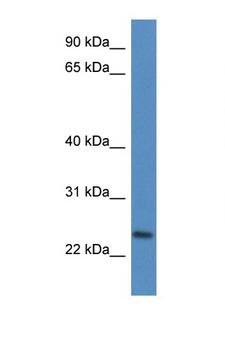 CD9 Antibody - CD9 antibody Western blot of Fetal Heart lysate. Antibody concentration 1 ug/ml.  This image was taken for the unconjugated form of this product. Other forms have not been tested.