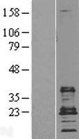 CD9 Protein - Western validation with an anti-DDK antibody * L: Control HEK293 lysate R: Over-expression lysate