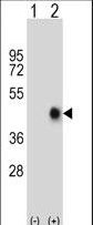 CD95 / FAS Antibody - Western blot of FAS (arrow) using rabbit polyclonal FAS Antibody. 293 cell lysates (2 ug/lane) either nontransfected (Lane 1) or transiently transfected (Lane 2) with the FAS gene.