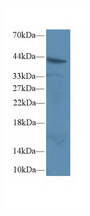 CD95 / FAS Antibody - Western Blot; Sample: Human Jurkat cell lysate; Primary Ab: 2µg/ml Rabbit Anti-Rat FAS Antibody Second Ab: 0.2µg/mL HRP-Linked Caprine Anti-Rabbit IgG Polyclonal Antibody