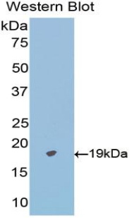 CD95 / FAS Antibody - Western blot of recombinant CD95 / FAS.  This image was taken for the unconjugated form of this product. Other forms have not been tested.